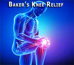 B-Relief Capsules. Alternative to Baker's Knee Cyst Surgery. 100% Natural 0% Recurrence Rate INFO bakerstreatment.com