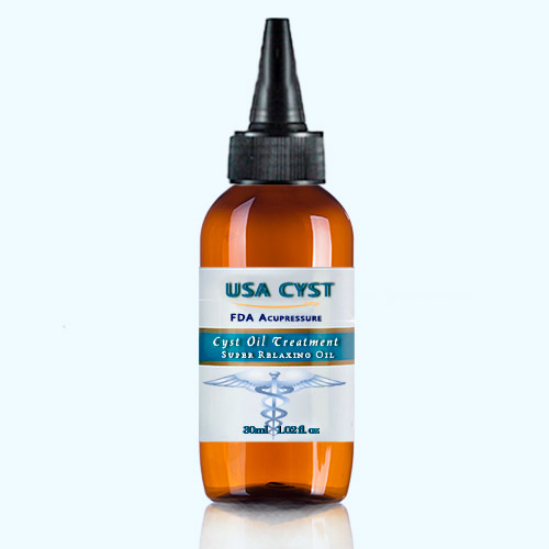 Acupressure G-Relief Cyst Oil Treatment